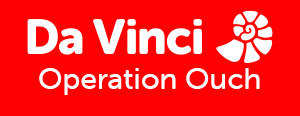 DaVinci Operation Ouch HD